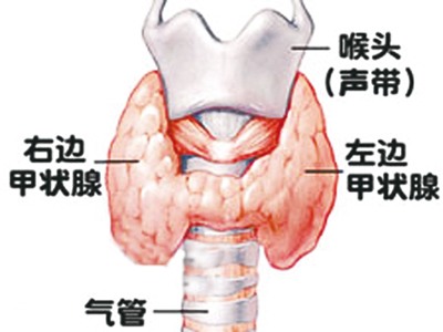 甲状腺癌三倍"偏爱"女性中青年女性最容易"中招"