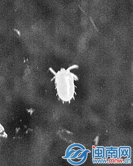 福清4个月大女婴被恙虫叮咬 高烧不退险丧命