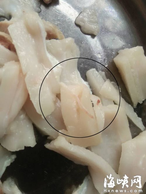 猪肉里长虫子?或为血管神经食用不影响健康