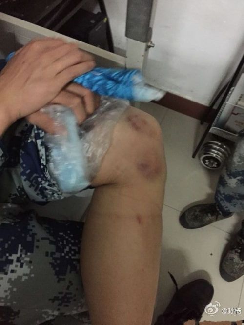 孙杨发文晒受伤淤青照话别真男2:心情复杂 遗憾不舍