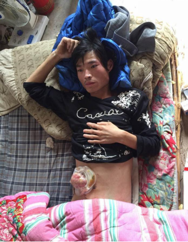 "小伙被捅肠子外露被赶出医院"事件现场图 真相披露