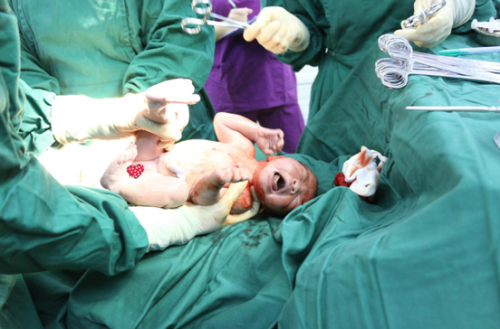 姗姗来迟的小公主,第一声啼哭