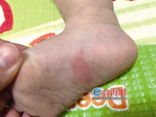 厦门一老人在小区养蜜蜂蜇伤邻家宝宝 经劝搬走蜂箱