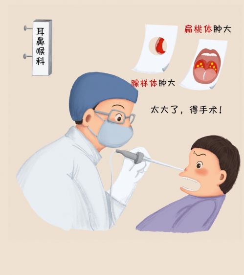 打呼噜十有八九是鼻子堵了,比如:鼻 炎,腺样体肥大,扁桃体肥大等